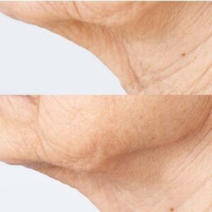 BRAND NEW! Perricone MD Cold Plasma Plus+ Essence in Black and Silver Tones